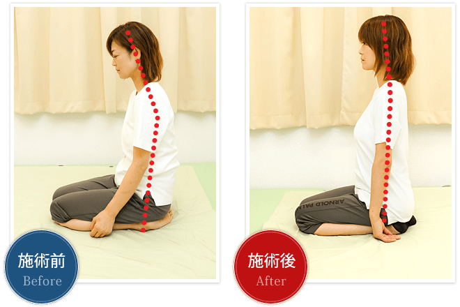 愛西市の理学整体あいさい腰の痛み専門院の施術による変化